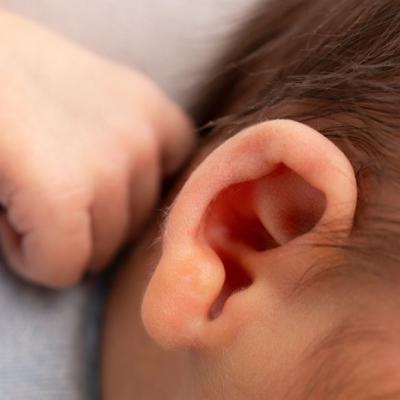 علل زخم پشت گوش نوزاد چیست؟ از خشکی و اگزما تا عفونت پوستی
